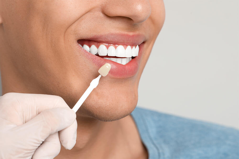 woman with beautiful teeth
